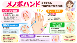 更年期の手の痛み